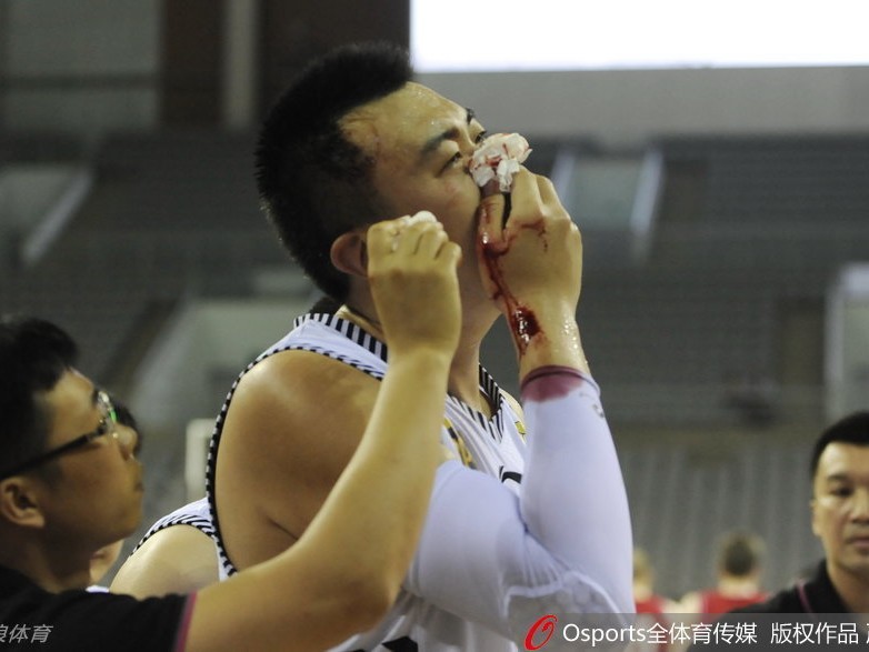 铁血硬汉韩德君赛场血染风采 鼻骨断裂不改擎天柱本色