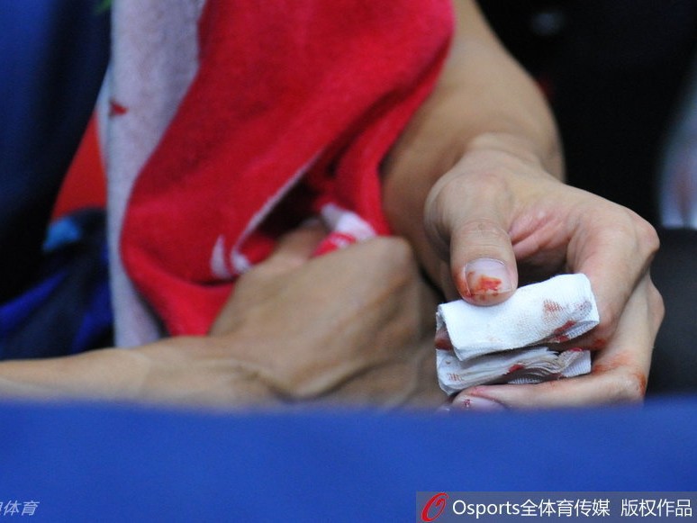 十指連心傷與恨：易建聯血灑總決賽之夜